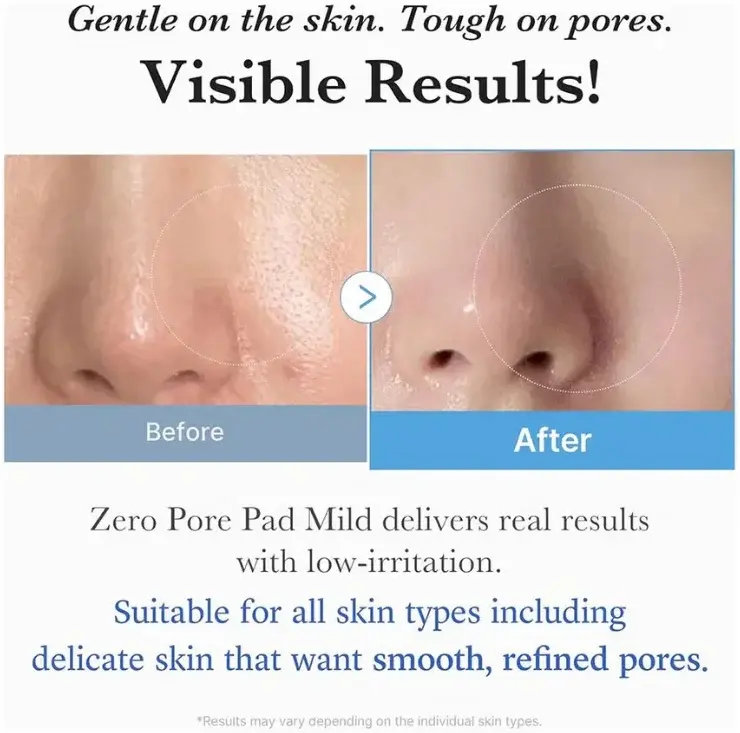 Medicube Zero Pore Pad Mild 155g